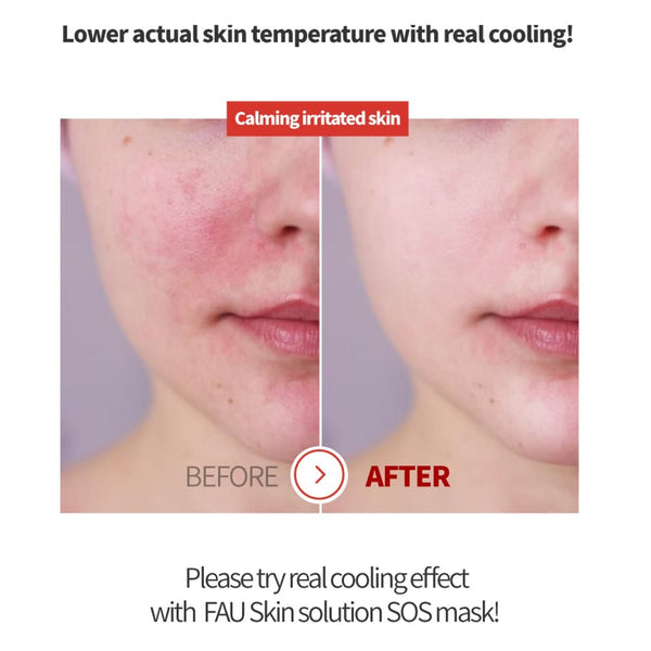 FAU Skin Solution SOS Mask Results Before And After